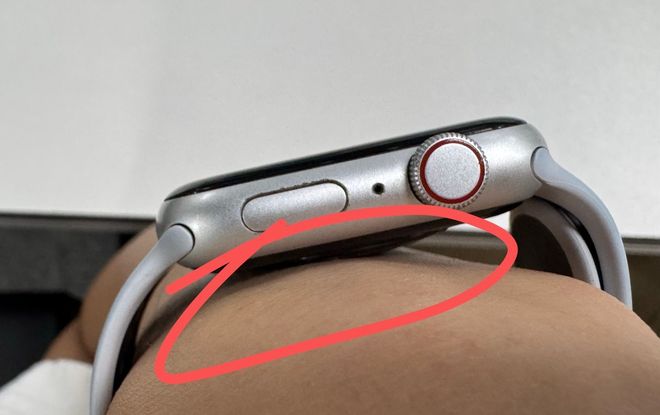 要选对材质佩戴方式也很重要智能手表导致皮