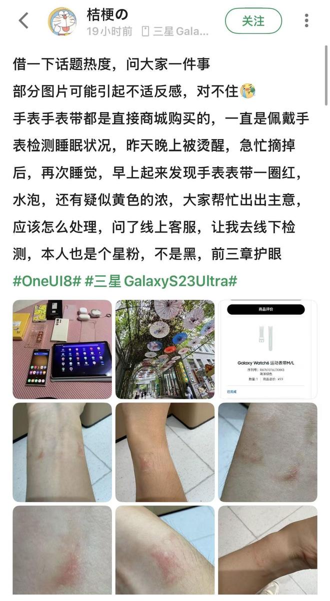 要选对材质佩戴方式也很重要智能手表导致皮肤红肿?不光(图6) 要选对材质佩戴方式也很重要智能手表导致皮肤红肿?不光(图6)